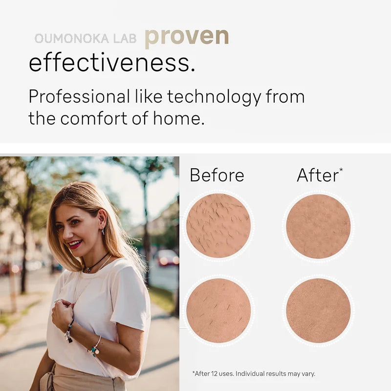 Body Bikini IPL 999,999 Flashes Depilator Pulses Permanent Laser Epilator Painless For Women Hair Removal Home Use Devices Dames & Queens Dreams-Lingerie