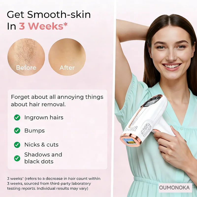 Body Bikini IPL 999,999 Flashes Depilator Pulses Permanent Laser Epilator Painless For Women Hair Removal Home Use Devices Dames & Queens Dreams-Lingerie